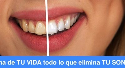 Alimentos y Bebidas que manchan los dientes
