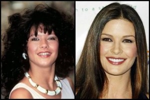Catherine zeta jones arreglo de sonrisa
