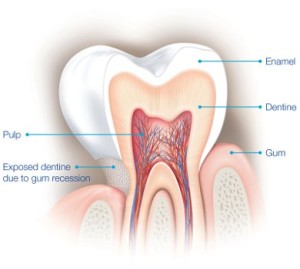 causas de la sensibilidad dental 1