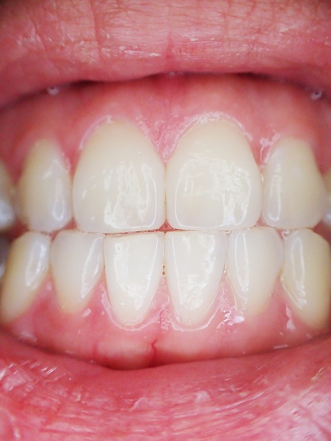 dientes sanos