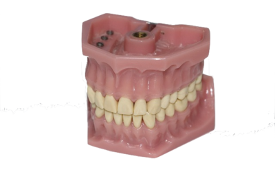 5 consejos útiles para comer con prótesis dentales