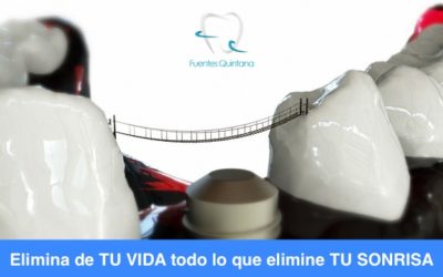 Qué es el implante dental