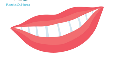 Gingivitis