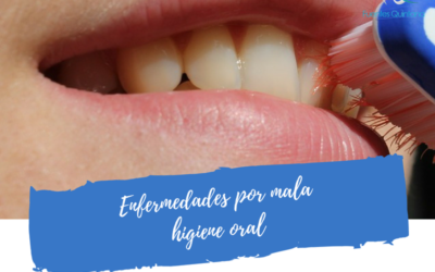 Enfermedades por mala higiene oral