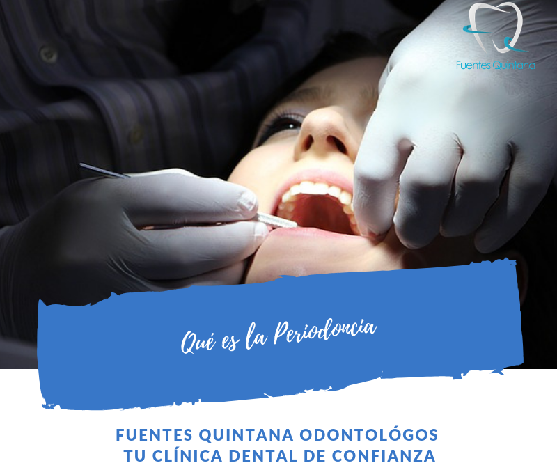 "Qué es la periodonica Clínica Fuentes Quintana Odontólogos Guadalajara"