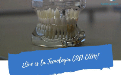 ¿Qué es la Tecnología CAD-CAM?