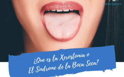 ¿Qué es la Xerostomía o El Síndrome de la Boca Seca?