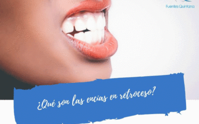 ¿Qué son las encías en retroceso?