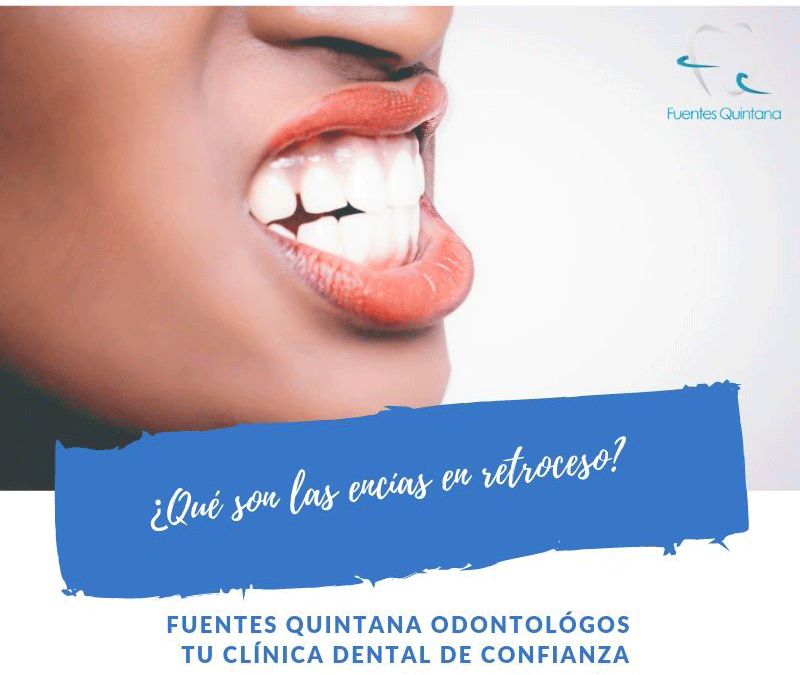 ¿Qué son las encías en retroceso?
