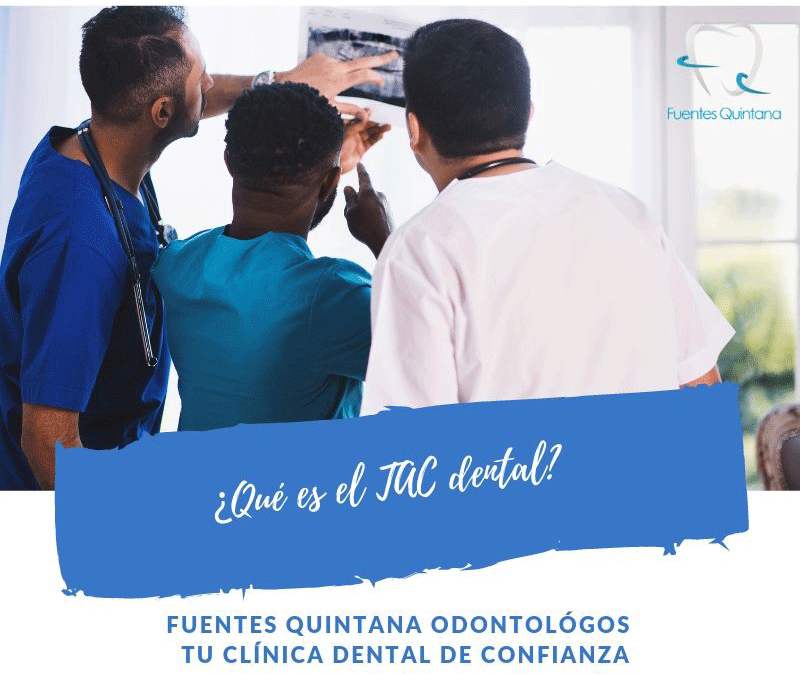 ¿Qué es un TAC Dental?
