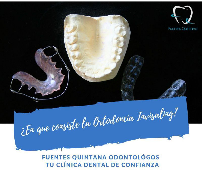 ¿En que consiste la Ortodoncia Invisaling?