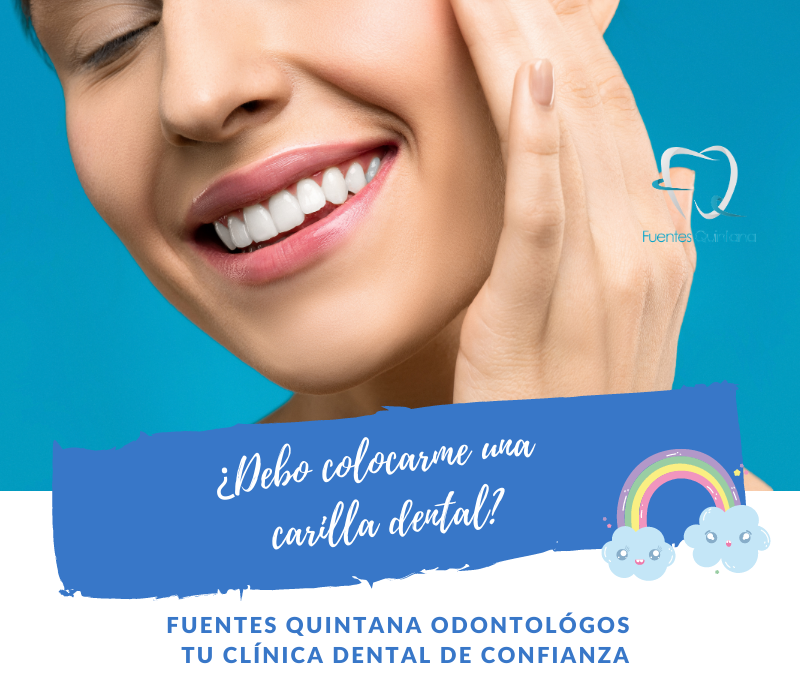 ¿Debo colocarme una carilla dental?