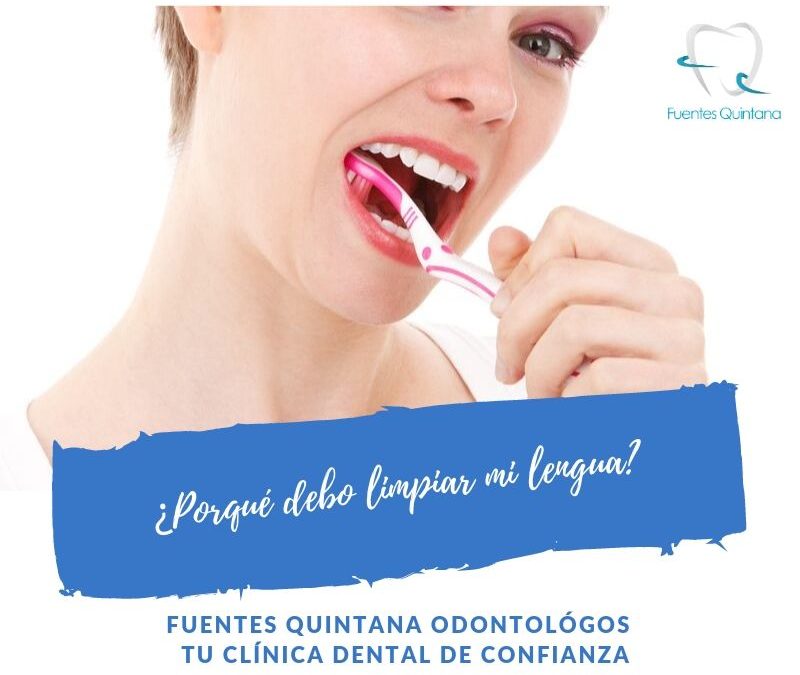 ¿Porqué debo limpiar mi lengua?