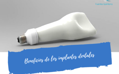 Beneficios de los implantes dentales