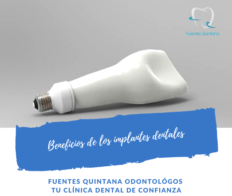 Beneficios de los implantes dentales-Clinica-Fuentes-Quintana-odontologos-Guadalajara