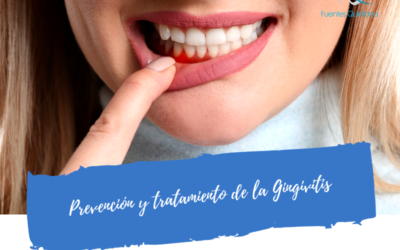 Prevención y tratamiento de la Gingivitis
