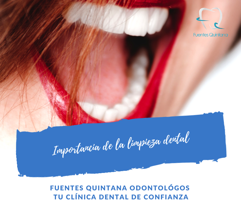 Importancia de la limpieza dental - Clinica Fuentes Quintana odontologos Guadalajara