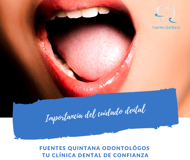 Importancia del cuidado dental - Clinica Fuentes Quintana odontologos Guadalajara