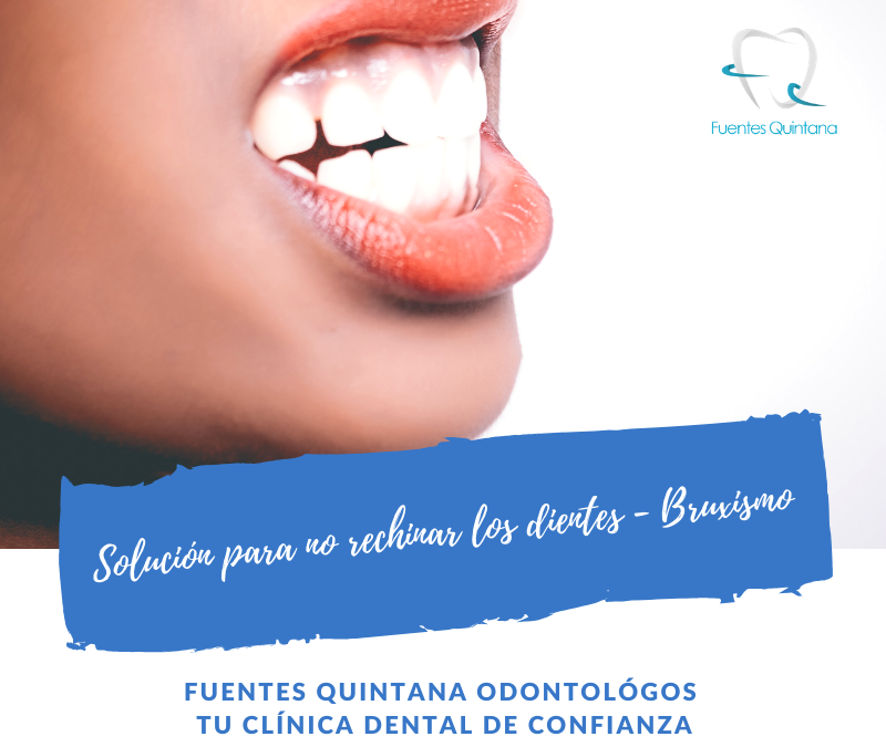Solución para no rechinar los dientes - Bruxismo - Clinica Fuentes Quintana odontologos Guadalajara
