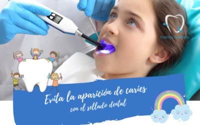 Evita la aparición de caries con el sellado dental