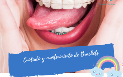 Cuidado y mantenimiento de brackets