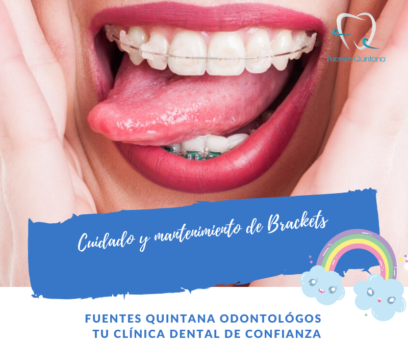 e damos algunos consejos necesarios para conseguir una buena rutina de higiene oral.