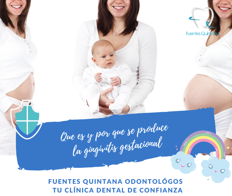 Que es y porque se genera la gingivitis gestacional