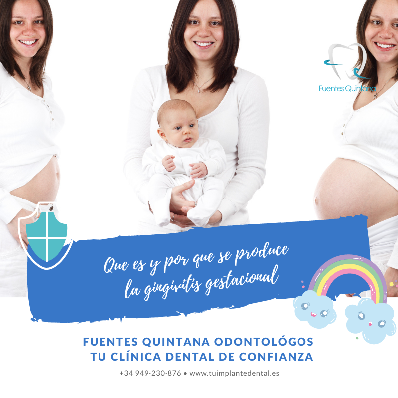Que es y porque se produce la gingivitis gestacional – Clinica Fuentes Quintana odontologos Guadalajara Que es y porque se produce la gingivitis gestacional - Clinica Fuentes Quintana odontologos Guadalajara