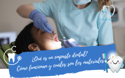 Qué son los empastes dentales