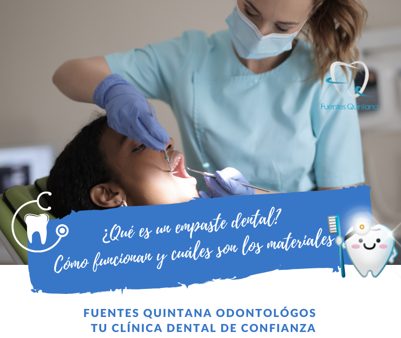 Qué son los empastes dentales