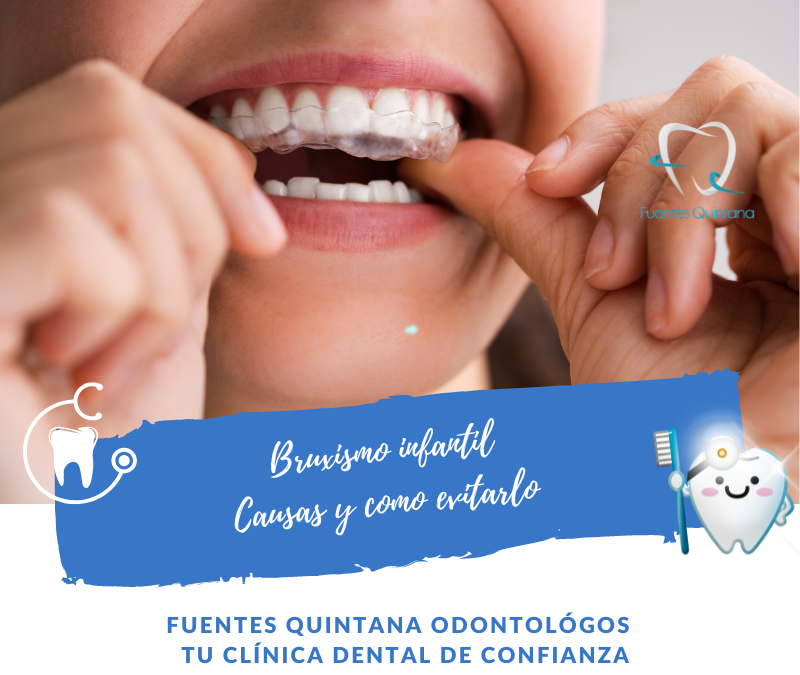 Bruxismo infantil. Causas y como evitarlo