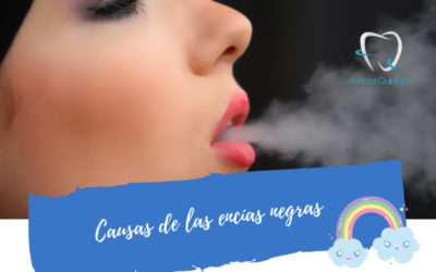 Causas de las encías negras
