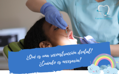 Qué es una reconstrucción dental