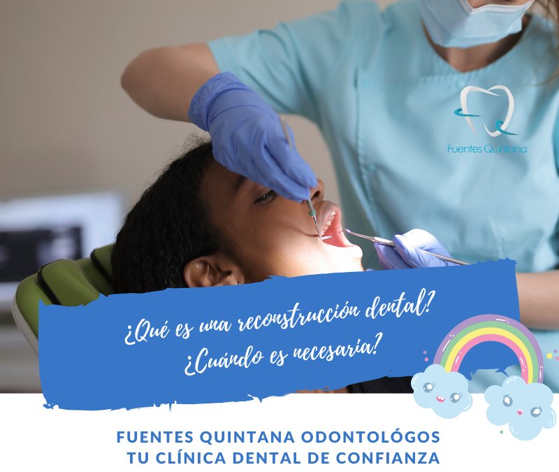Que es una reconstruccion dental - Clinica Fuentes Quintana odontologos Guadalajara