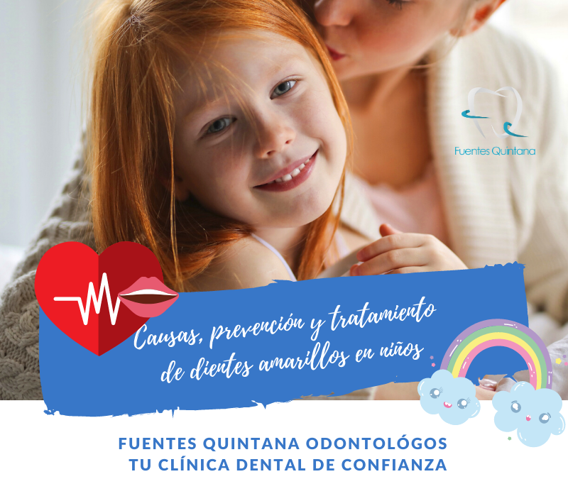 Causas, prevención y tratamiento de dientes amarillos en niños