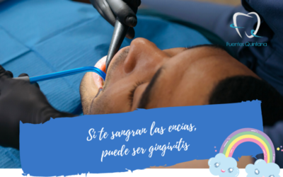 Si te sangran las encías, puede ser gingivitis