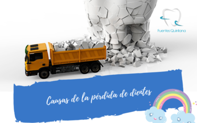Causas de la pérdida de dientes