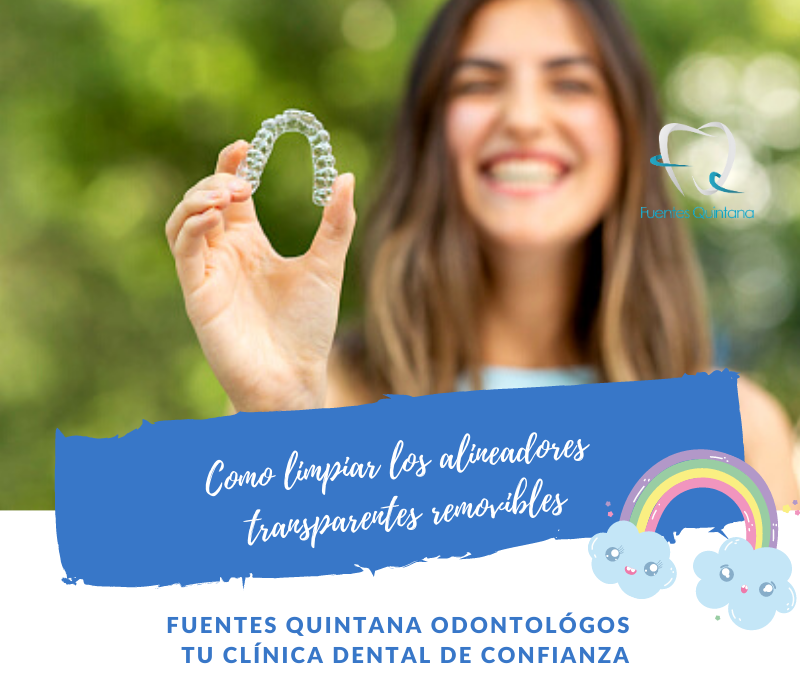 Como limpiar los alineadores transparentes removibles