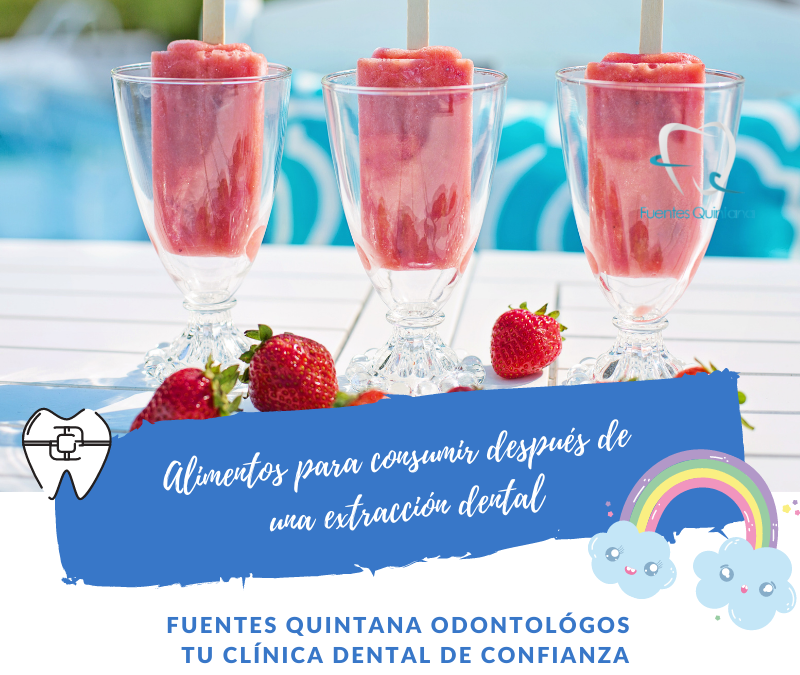 Alimentos para consumir después de una extracción dental- Tu implante dental