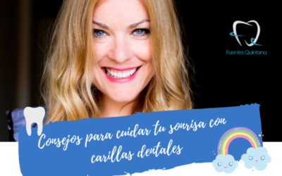 Consejos para cuidar tu sonrisa con carillas dentales