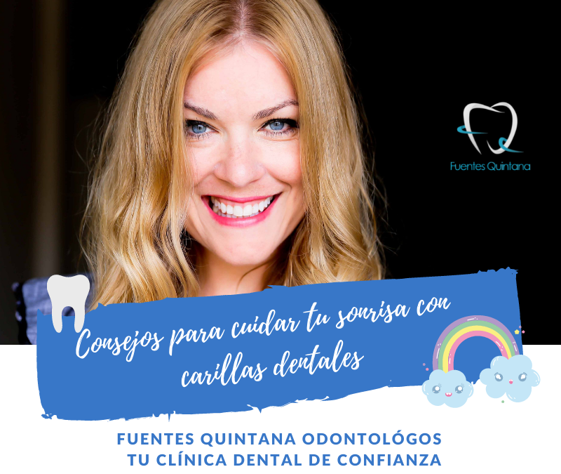 Consejos para cuidar tu sonrisa con carillas dentales