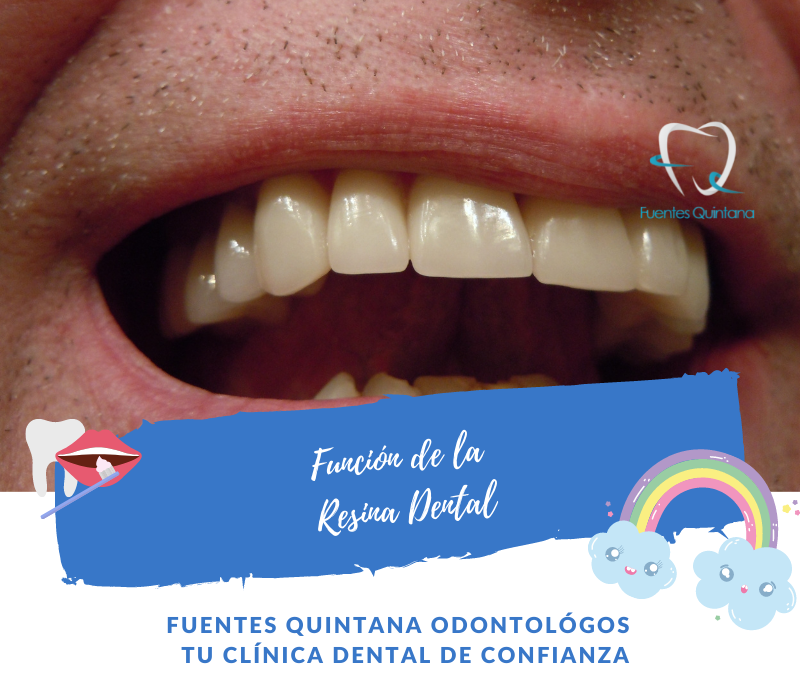 Función de la Resina Dental