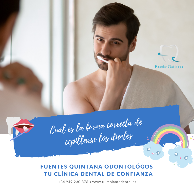 Cual Es La Forma Correcta De Cepillarse Los Dientes- Tu Implante Dental ...