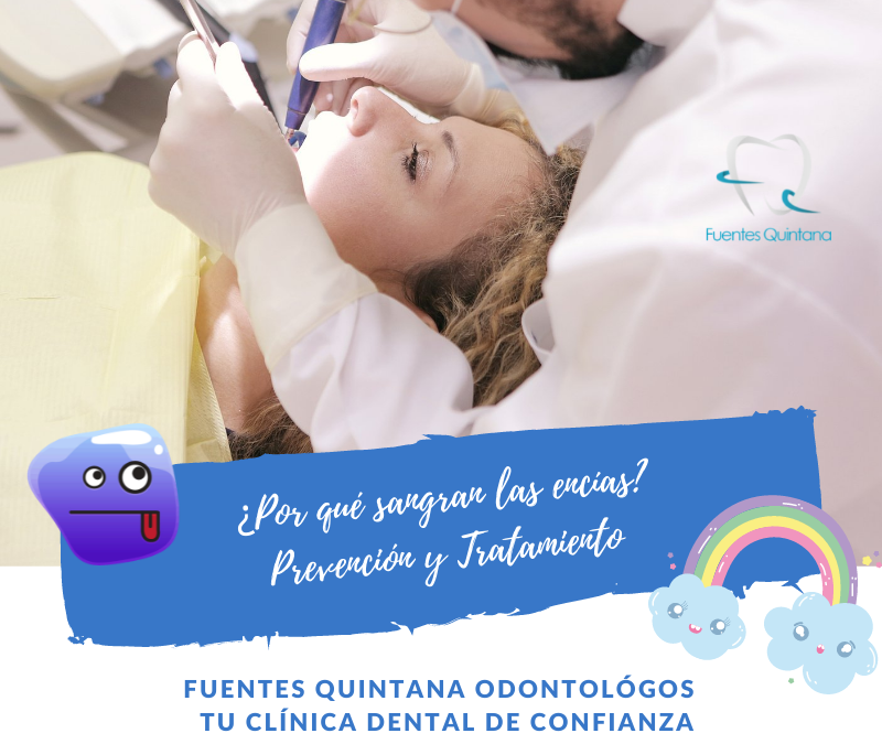 Por qué sangran las encías - Tu implante dental - Clinica dental Fuentes Quintana