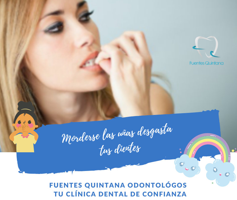 Morderse las uñas desgasta tus dientes - Clinica Fuentes Quintana Guadalajara Odontologos