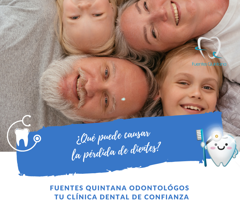 Cuáles son las causas de la pérdida de dientes