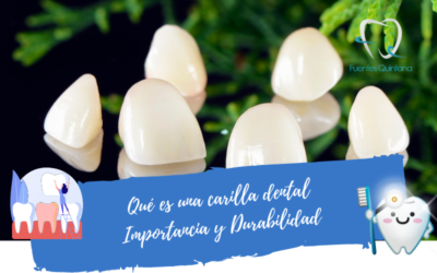 Qué es una carilla dental