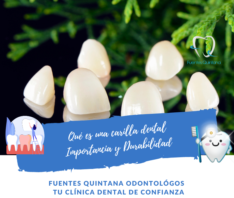 que es una carilla dental - Clinica Fuentes Quintana Guadalajara Odontologos