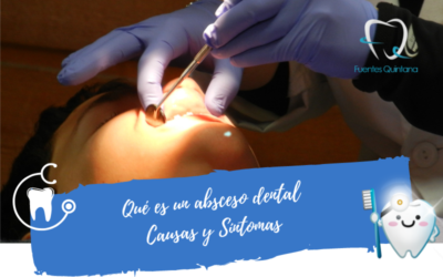 Qué es un absceso dental