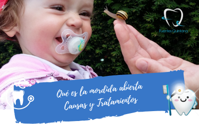 Qué es la mordida abierta o maloclusión dental